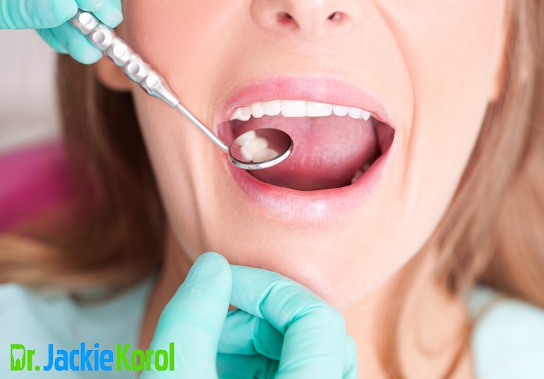 Dental Fillings Calgary