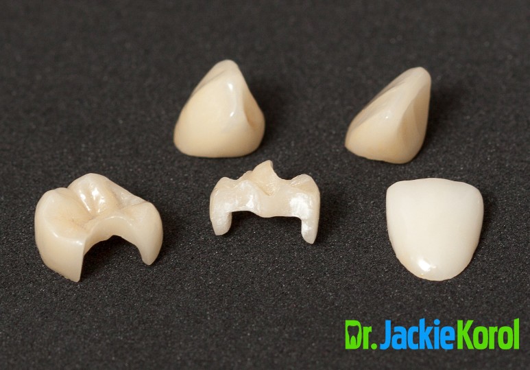preserve enamel calgary dentist
