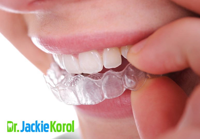 5 Ways to Get The Best Invisalign Results 