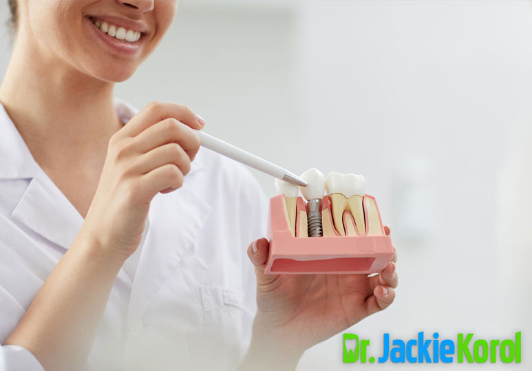 Benefits Of Dental Implants | Dr. Korol Dental