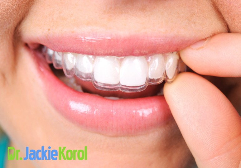 Calgary Invisalign