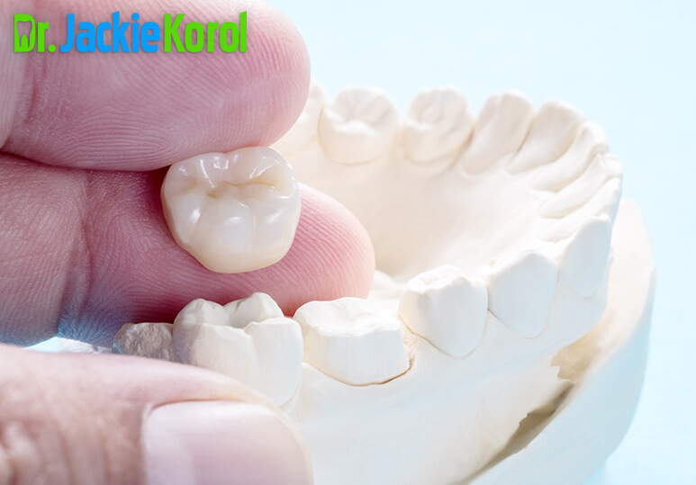 Dr Jackie Korol - Blog - Ceramic Teeth