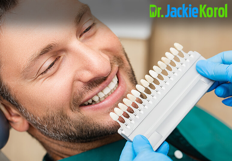 Considering Veneers? Here Is What You Need To Know | Calgary Dentist