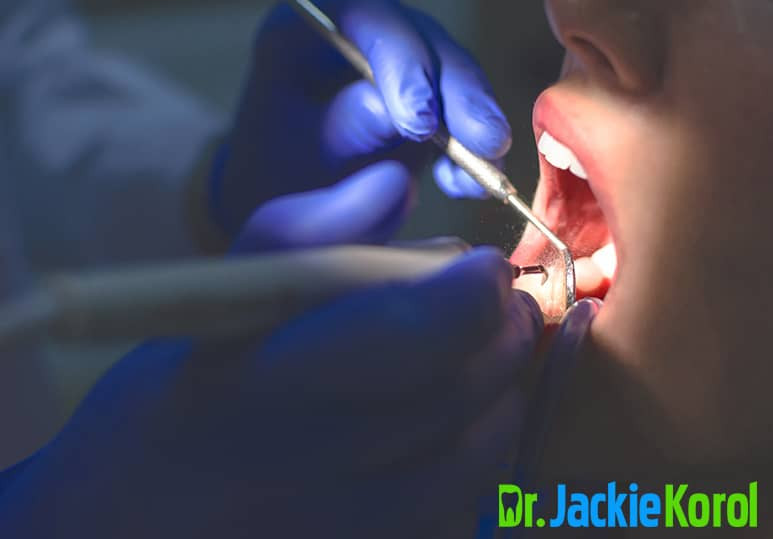 Dr Jackie Korol - Blog -  Is It Safe To Remove My Mercury Fillings