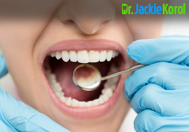 Dental Crowns: Everything You Need To Know